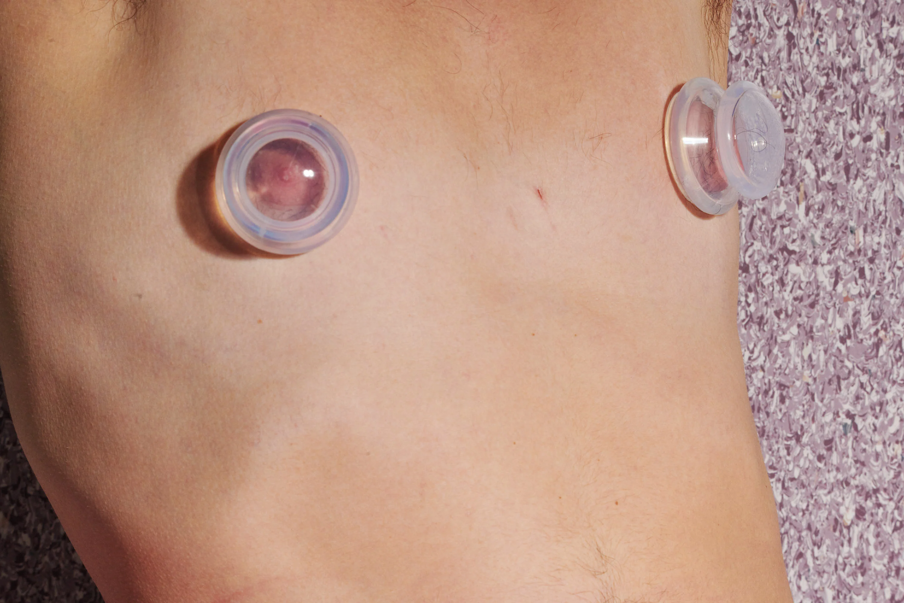 Clear Plungers Silicone Nipple Suckers - Large - Image 6