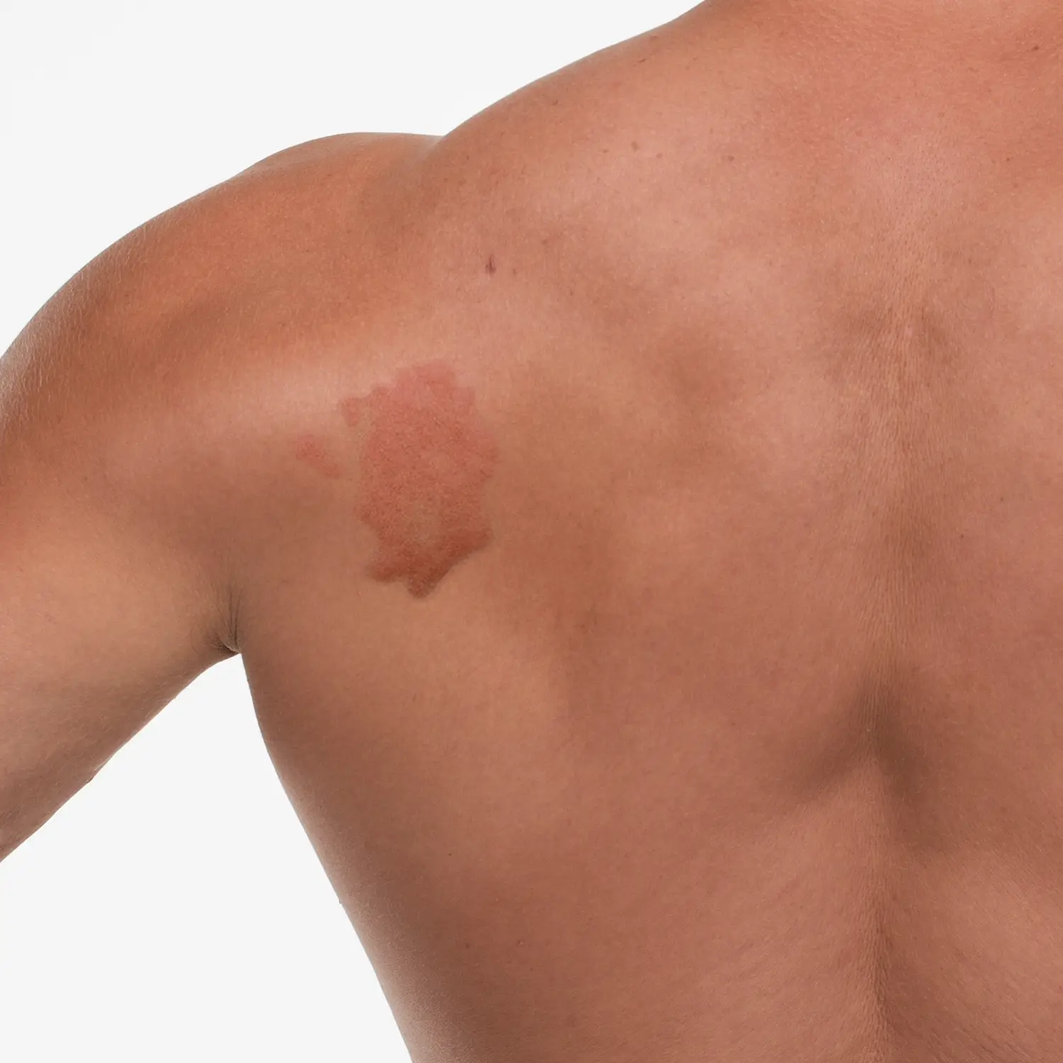 HOCL FACIAL SPRAY - Image 4