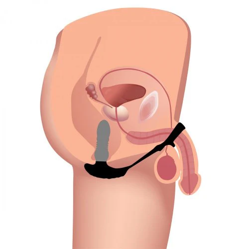 THUNDERPLUGS 10X THRUSTING SILICONE PLUG W/ COCK AND BALL RING - Image 5